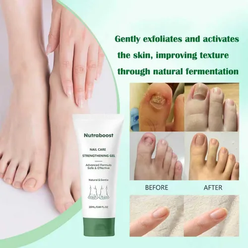 Vista 4 de Nutraboost Gel natural para el cuidado de uñas, suero fortalecedor para cutículas para uñas dañadas y quebradizas, 0.7 fl oz (1 unidad) (2 unidades)