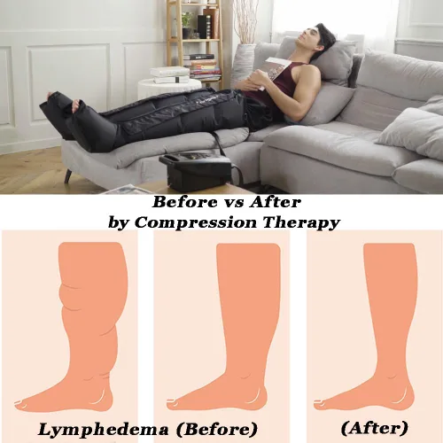 Vista 3 de Botas de terapia de compresión de aire para pies de LONGEST, bombas de linfedema para piernas Sistema de recuperación linfática de compresión