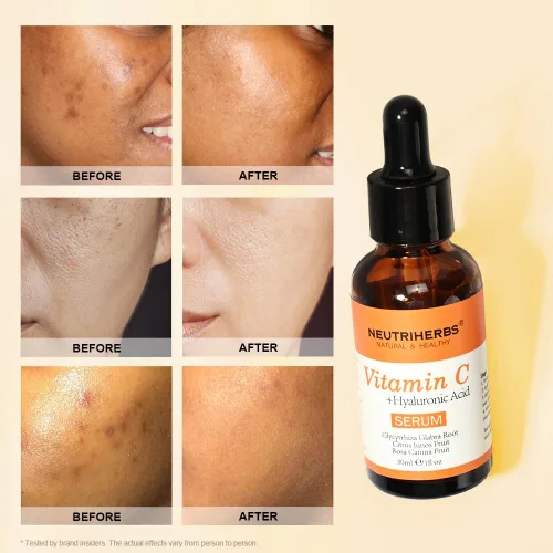 Vista 5 de NEUTRIHERBS Suero de vitamina C para la cara con ácido hialurónico, firme, antienvejecimiento, ilumina, uniforme, piel, cuidado diario de la piel