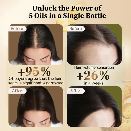 Vista 9 de Aceite de batana para el crecimiento del cabello y aceite de Cinchona incluye aplicador de cuero cabelludo, reparación del cuero cabelludo y cabello