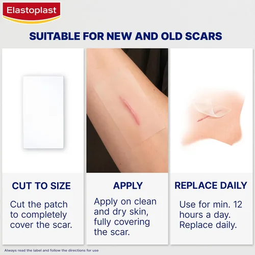 Vista 6 de Elastoplast Yesos reductores de cicatrices (21 piezas), tratamiento rápido y cómodo para cubrir cicatrices, hojas de cicatrices para reducir