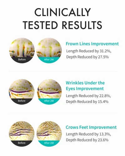 Vista 3 de REJURAN Crema intensiva para ojos, c-PDRN - Tratamiento ocular de acción rápida para arrugas, levantamiento y ojeras. Hidratación instantánea