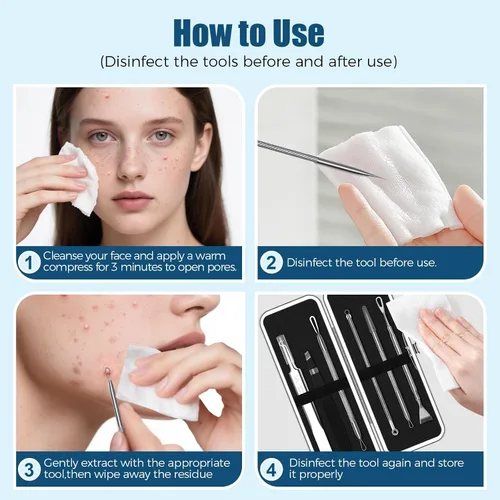 Vista 7 de Kit de herramientas para eliminar puntos negros, juego de 6 extractores de espinillas con agujas de acné, pinzas, raspador de poros para manchas