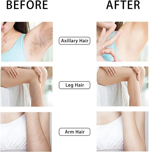 Vista 6 de Borrador de pelo de cristal para mujer, borrador reutilizable para el cabello, removedor de pelo de cristal, borrador de pelo para mujeres