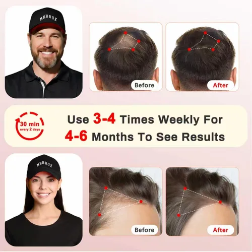 Vista 5 de Gorra de crecimiento del cabello con luz roja, 528 emisores de luz total, terapia de luz roja para el cabello, ajuste ajustable, sesiones en casa