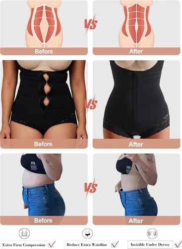 Vista 2 de OMKAGI Fajas moldeadoras de corsé para mujer con control de abdomen, colombianas, moldeadoras, body de compresión