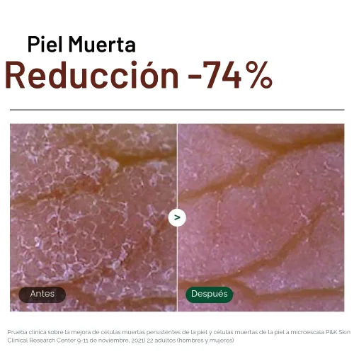 Vista 4 de Dr. G Gel Exfoliante Iluminador, cuidado de la piel coreano para una piel radiante, exfoliante facial Aqua Gommage, ácido hialurónico, ceramidas