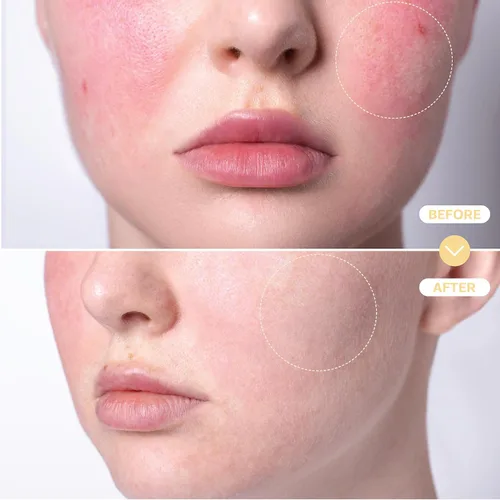 Vista 4 de BASE LABORATORIES Spray de Ácido Hipocloroso para Cara y Piel - Tamaño de Viaje - Spray Tónico Facial y Limpiador - Solución de Reparación