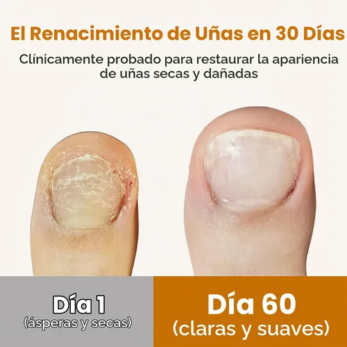 Vista 2 de TuneTune - Aceite para cutículas de 0.3 fl oz Aceite de uñas coreano fermentado para uñas y cutículas Aceite hidratante para cutículas secas