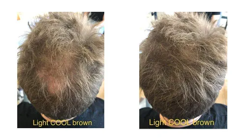 Vista 3 de FEBRON Fibras capilares para adelgazar el cabello para mujeres y hombres, corrector de pérdida de cabello, polvo para el cabello, base de Marrón