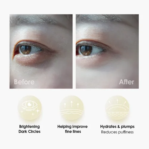 Vista 5 de Sweet Dreams - Máscaras de colágeno para ojos dorados, parches debajo de los ojos para ojos hinchados + máscara de labios de vainilla Sweet Dreams