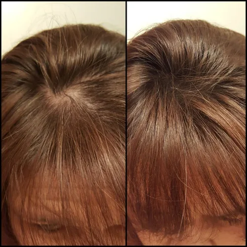 Vista 4 de Solución para cabello ralo - Fibras totalmente naturales a base de plantas para una apariencia más completa y gruesa. Cubre instantáneamente