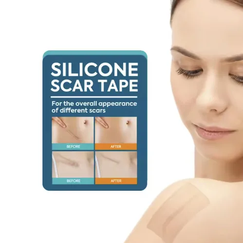 Vista 6 de Hojas de silicona para cicatrices de 1.6 x 120 pulgadas, grado médico, de larga duración, rollo de cinta reutilizable para cesárea, cicatrices