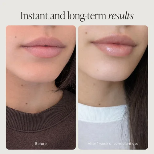 Vista 4 de Bálsamo labial de calvo alimentado con hierba, máscara para dormir labial, hidratante durante la noche, bálsamo labial hidratante natural y limpio