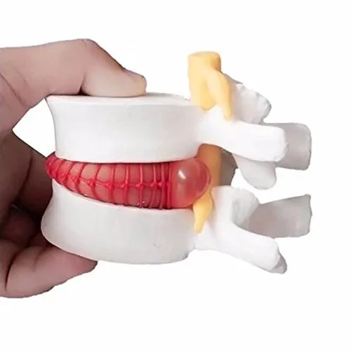 Vista 2 de DENTAL Color blanco oral 1:1.5 vértebras lumbares humanas anatómicas degenerativas lumbares modelo de columna vertebral humana US Stock