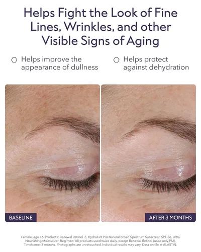 Vista 3 de ALASTIN Skincare Suero Facial de Retinol para Renovación de la Piel Antienvejecimiento, Disminuye las Líneas Finas y las Arrugas Repara