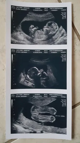Vista 5 de Broma 2D personalizada tira de ultrasonido falso de 3 fotos