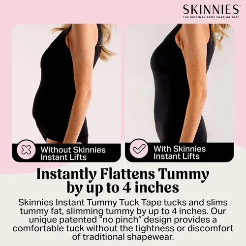 Vista 2 de Skinnies Instant Lifts - Cinta adhesiva para abdominoplastia patentada, fabricada en Estados Unidos, para vientre delgado de 3 a 4 pulgadas al