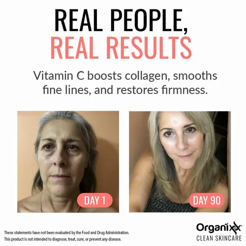 Vista 4 de Organixx Restore Vitamin C, suero facial diario con ácido hialurónico, vitamina E orgánica, hamamelis, glicerina y aloe vera, fórmula iluminadora