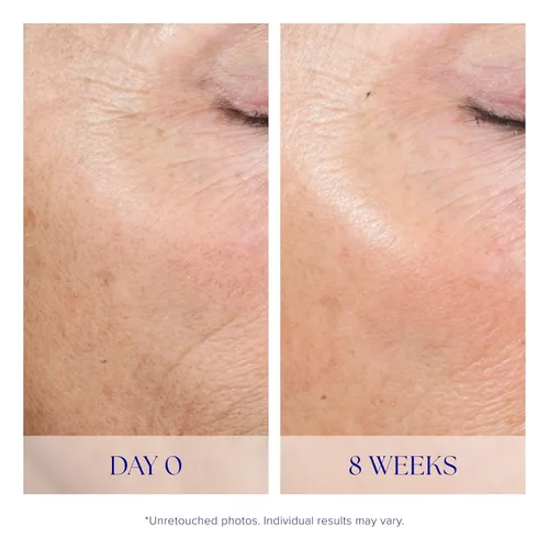 Vista 7 de iS CLINICAL Active Peel System, sistema de peeling suave en casa de dos pasos para exfoliación facial