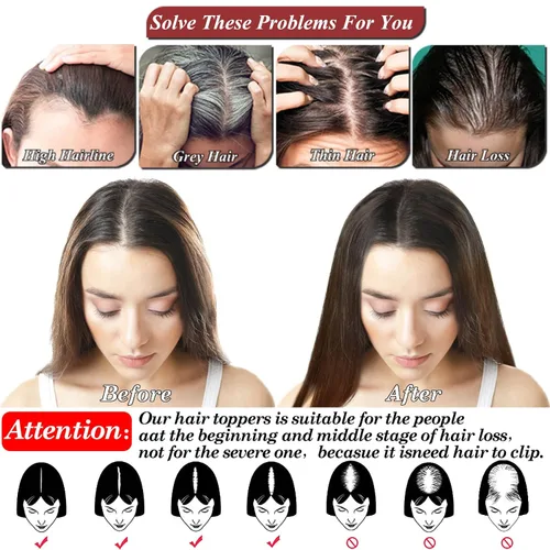 Vista 6 de JGS1996 Toppers de cabello humano real para mujer, 150% de densidad, hecha a mano, base de encaje, peluca de cabello Remy con piezas de cabello Dark