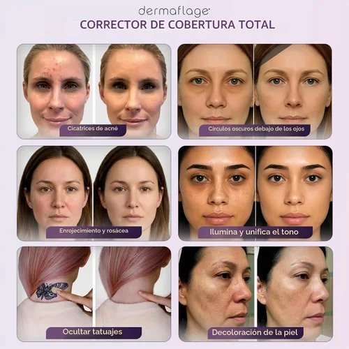 Vista 7 de Dermaflage Crema Correctora para Acné y Tatuaje Cover Up - Bronce Oscuro
