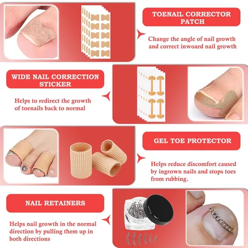 Vista 5 de Kit de eliminación de uñas encarnadas, tratamiento profesional de uñas encarnadas, kit de herramientas de uñas encarnadas con gotas correctoras