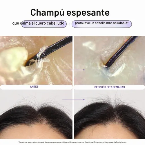 Vista 2 de Dr. Groot Champú para engrosar el cabello, cuidado coreano del cabello con biotina, aceite de romero para ayudar a dar volumen al adelgazamiento