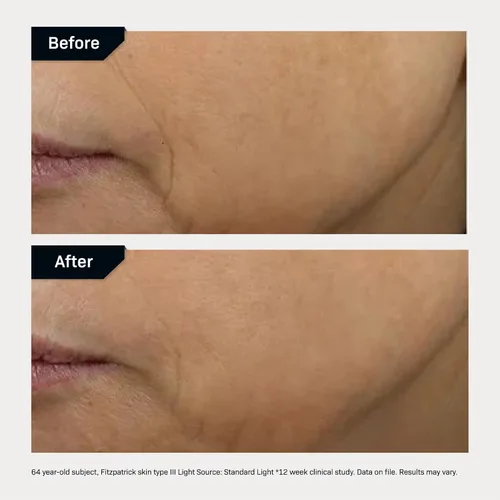 Vista 6 de Revision Skincare D·E·J Face Cream®, Advanced Anti Aging Moisturizer, Lifting and Firming, Antioxidant Rich