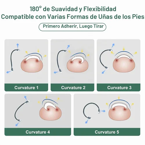 Vista 5 de Corrector de uñas encarnadas de nitinol dual, tratamiento de uñas encarnadas, enderezador de uñas curvas, kit de eliminación de uñas encarnadas