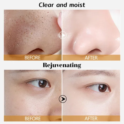 Vista 6 de Rednow Máscara de lámina dorada, antiarrugas, 98.4 % de oro, máscara facial dorada antienvejecimiento para hidratar, elimina puntos negros, reduce