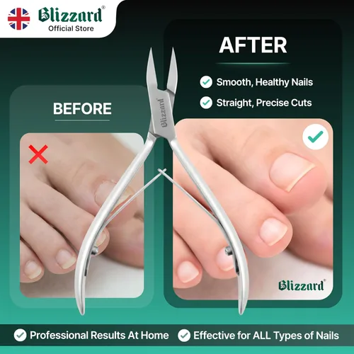 Vista 5 de Blizzard - Cortaúñas encarnadas, podólogo, podólogo, uñas gruesas para personas mayores, pinzas encarnadas para hombres, herramienta de podología