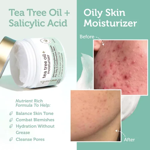 Vista 5 de Crema facial de aceite para árbol de té – para aceite, piel de acné con crema hidratante facial natural y orgánico de 5 ml con 7 ingredientes