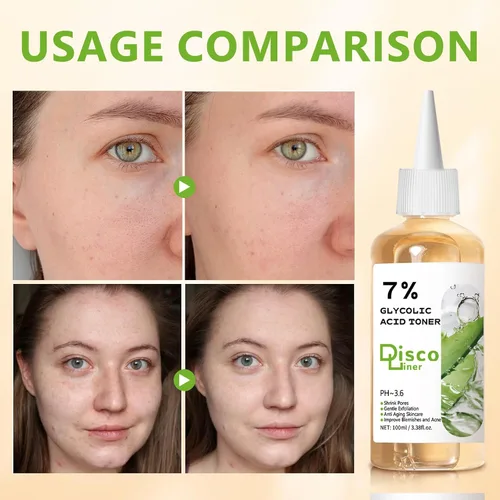 Vista 4 de Tónico exfoliante de ácido glicólico al 7%, tóner facial hidratante, piel suave y brillante, tono de piel uniforme, mejora la textura de la piel