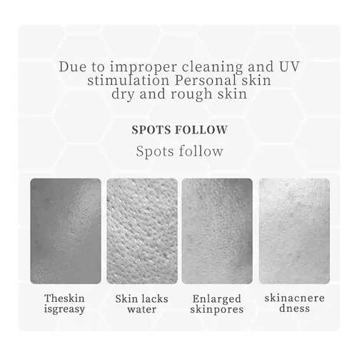 Vista 7 de BIOAQUA Limpiador facial de miel de Manuka Vitamina E Espuma de limpieza profunda Reparación de la piel de la cara Suavizar Hidratante Hidratante