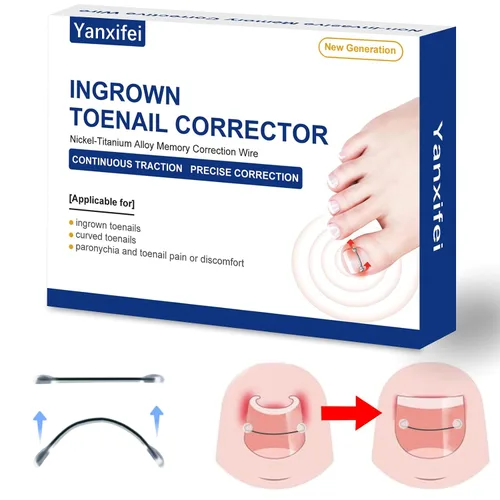 Vista 7 de Corrector de uñas encarnadas de nitinol dual, tratamiento de uñas encarnadas, enderezador de uñas curvas, kit de eliminación de uñas encarnadas