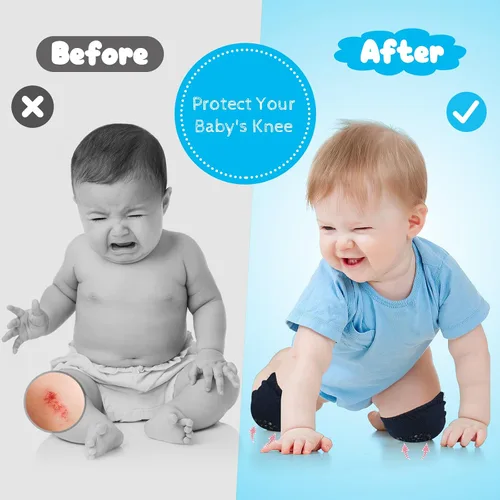 Vista 4 de Almohadillas antideslizantes para gatear para bebés, protegen la rodilla del bebé para gatear