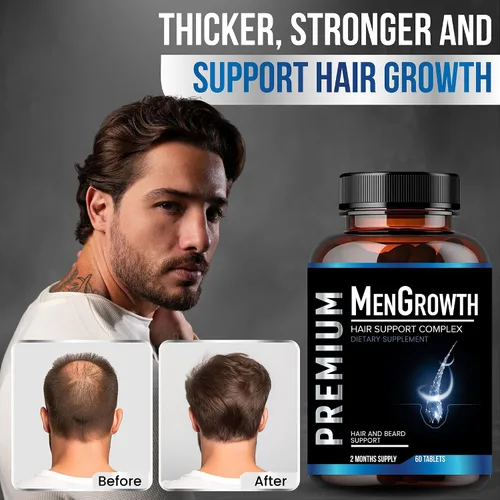 Vista 6 de NutraPro Vitaminas para el crecimiento del cabello para hombres, suplemento anti pérdida de cabello.