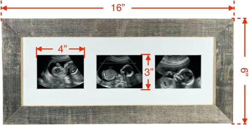 Vista 4 de BARNWOODUSA Marco de fotos Sonogram Marco de fotos de recuerdo de progresión de ultrasonido de bebé Marco de fotos de hitos del embarazo 1