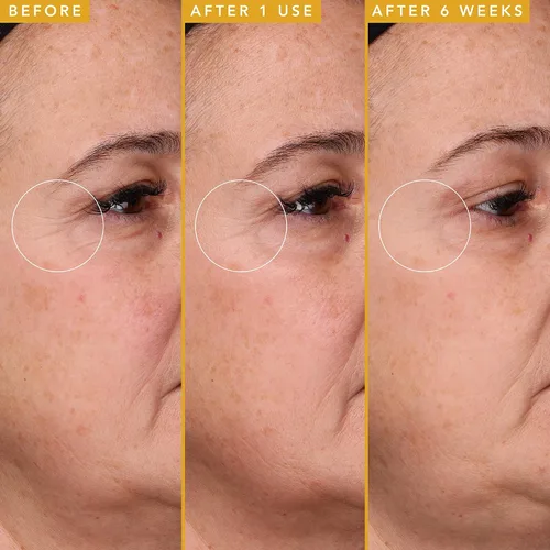 Vista 4 de Farmacy Suero de ácido hialurónico para la cara, suero facial con péptidos de colágeno veganos, ayuda a suavizar las líneas finas + las arrugas