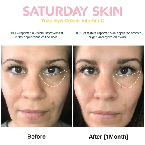 Vista 5 de Saturday Skin Yuzu - Bálsamo para ojos con vitamina C, crema iluminadora para debajo de los ojos apretados, niacinamida coreana, cafeína