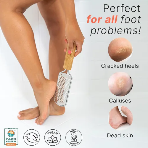 Vista 3 de Lima de pies – Herramienta para eliminar callos para la piel muerta, herramientas de pedicura en casa, raspador de pies y talones, pies suaves