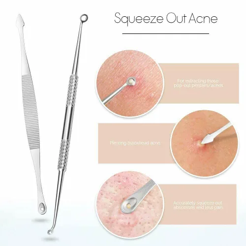 Vista 2 de Kit de herramientas para reventar espinillas, kit de 9 piezas de extractor de espinillas para eliminación rápida y fácil de espinillas, puntos