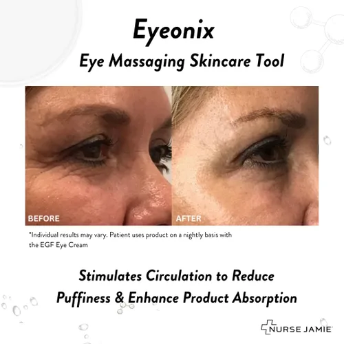 Vista 7 de Nurse Jamie Eyeonix - Herramienta de belleza para masaje ocular