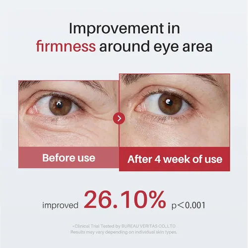 Vista 6 de SPODARE Suero de ojos con cafeína y retinol para ojeras, hinchazón y arrugas, crema debajo de los ojos con ácido hialurónico, niacinamida