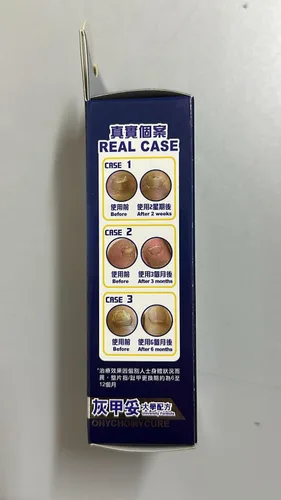 Vista 5 de NOTO Onychomycure Strength Reparación de uñas de los pies - Uñas saludables/pies, cuidado de pies, solución de renovación de apariencia, arreglar
