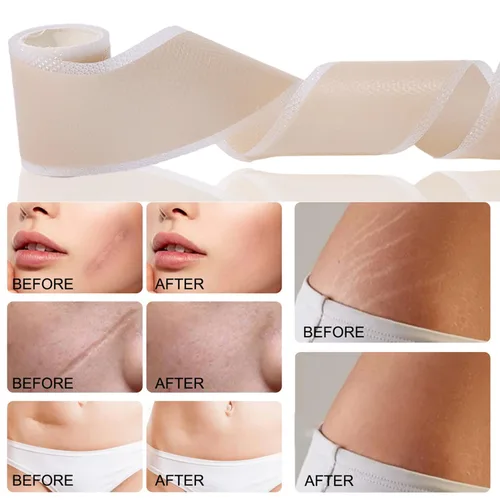 Vista 5 de Láminas de silicona anchas impermeables para reparación de la piel, cubierta autoadhesiva, tatuajes, cicatrices, calcomanías para el cuidado