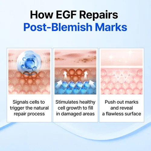 Vista 4 de DearKlairs - Suero coreano EGF – Gota activadora juvenil azul con EGF y FGF (10 ppm cada uno), reparación de barrera y marcas post-imperfección