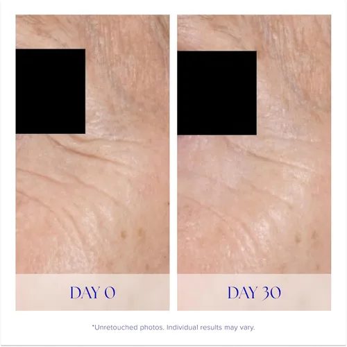 Vista 4 de iS CLINICAL Youth Eye Complex, crema iluminadora antienvejecimiento para debajo de los ojos, reduce la hinchazón, crema hidratante y reafirmante