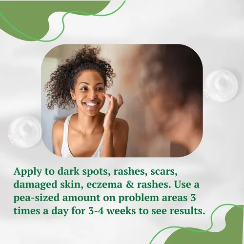Vista 4 de Crema de aloe vera, corrige marcas oscuras, piel seca y nuevas cicatrices en el cuerpo, crema facial para imperfecciones, reduce la apariencia